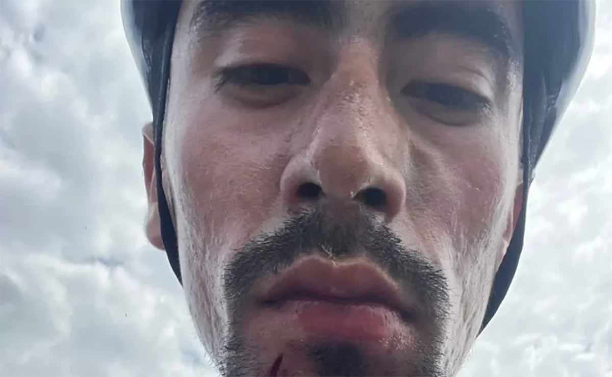 Le golpearon con la culata de una pistola. El ciclista del Movistar Team tras una discusión de tráfico