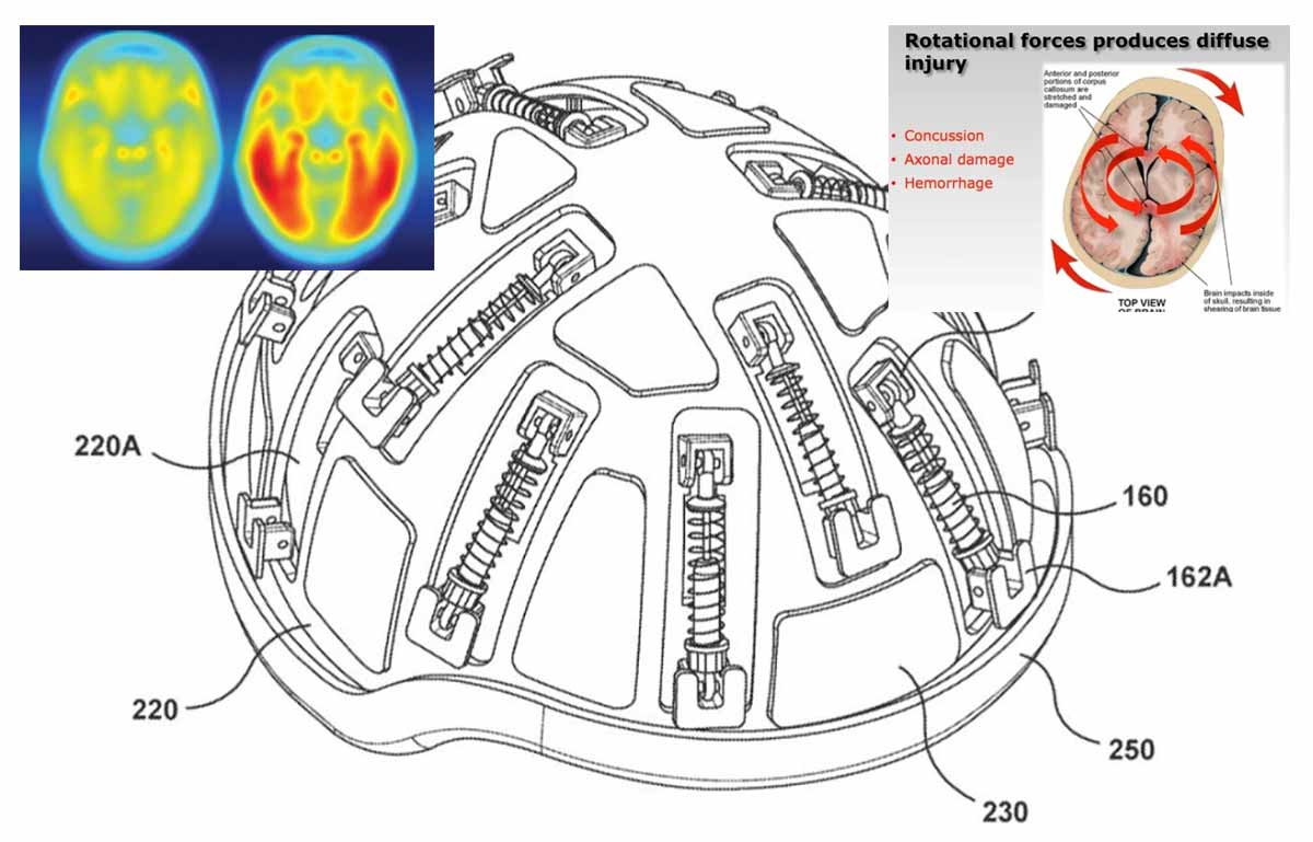 Un-casco-con-varios-amortiguadores-para-reducir-las-lesione-cerebrales
